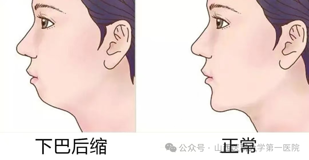 一飞冲天